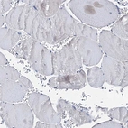 Immunohistochemical staining of human skeletal muscle shows low expression as expected.