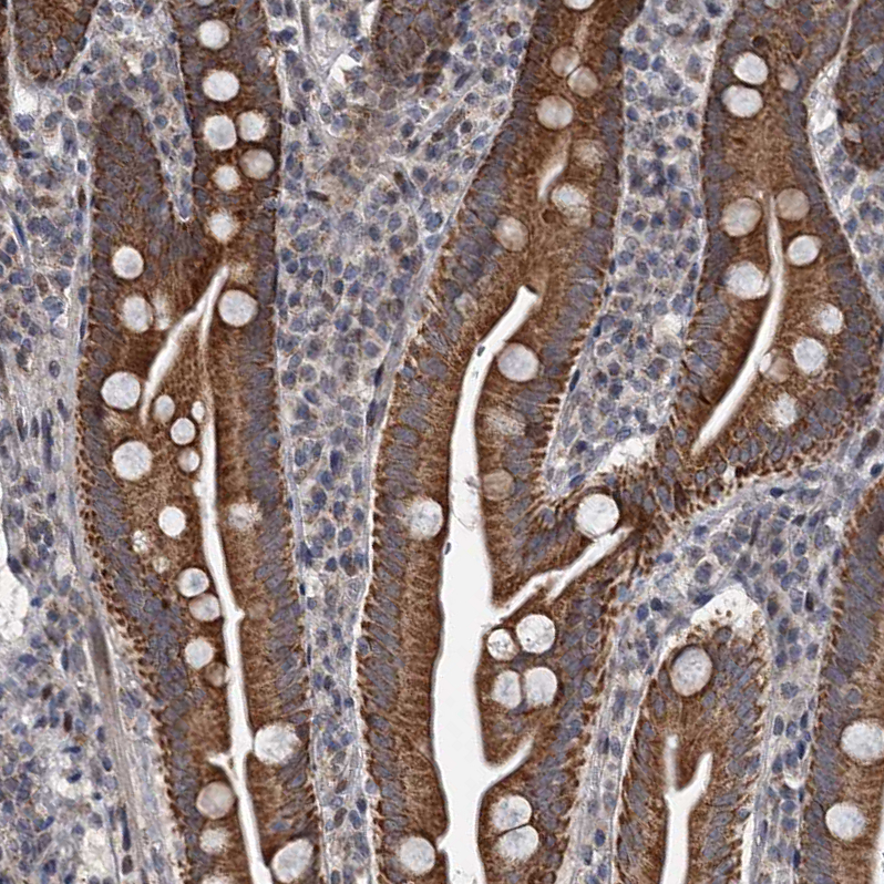 Anti-RITA1 Antibody