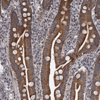 Anti-RITA1 Antibody