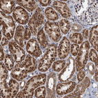 Immunohistochemical staining of human kidney shows strong granular cytoplasmic positivity in cells in tubules.