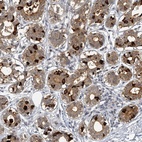 Immunohistochemical staining of human breast shows moderateto strong cytoplasmic positivity in glandular cells.