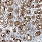 Immunohistochemical staining of human breast shows moderateto strong cytoplasmic positivity in glandular cells.