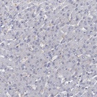 Immunohistochemical staining of human liver shows no positivity in hepatocytes as expected.