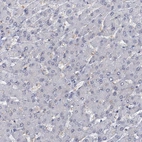 Immunohistochemical staining of human liver shows no positivity in hepatocytes as expected.