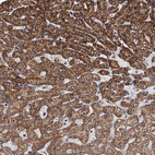 Immunohistochemical staining of human liver shows strong granular cytoplasmic positivity in hepatocytes.