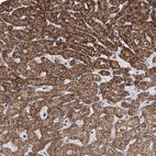 Immunohistochemical staining of human liver shows strong granular cytoplasmic positivity in hepatocytes.