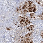 Anti-MUCL1 Antibody