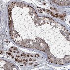 Immunohistochemical staining of human testis shows strong granular cytoplasmic positivity in Leydig cells.