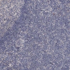 Immunohistochemical staining of human tonsil shows no positivity in non-germinal center cells as expected.