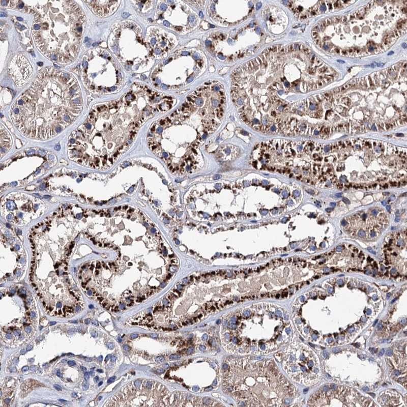 Anti-SCPEP1 Antibody