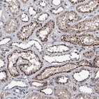 Anti-SCPEP1 Antibody