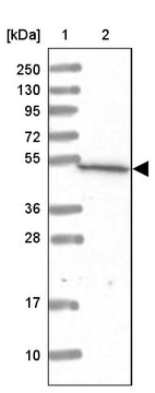 Lane 1: Marker [kDa] 250, 130, 95, 72, 55, 36, 28, 17, 10_br/_Lane 2: Human cell line RT-4
