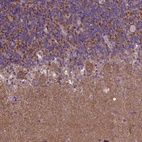 Anti-GPR63 Antibody