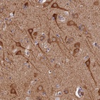 Anti-PIGQ Antibody