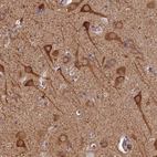 Anti-PIGQ Antibody