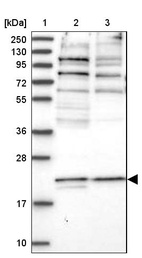 Lane 1: Marker [kDa] 250, 130, 95, 72, 55, 36, 28, 17, 10_br/_Lane 2: Human cell line RT-4_br/_Lane 3: Human cell line U-251MG sp
