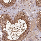 Anti-RSPH3 Antibody