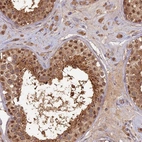 Anti-RSPH3 Antibody