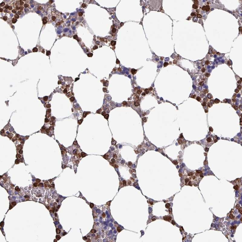 Anti-UQCC2 Antibody