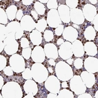 Anti-UQCC2 Antibody