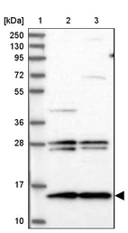 Lane 1: Marker [kDa] 250, 130, 95, 72, 55, 36, 28, 17, 10_br/_Lane 2: Human cell line RT-4_br/_Lane 3: Human cell line U-251MG sp