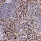Anti-KLRB1 Antibody