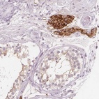 Anti-C1orf167 Antibody