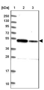 Lane 1: Marker [kDa] 250, 130, 95, 72, 55, 36, 28, 17, 10_br/_Lane 2: Human cell line RT-4_br/_Lane 3: Human cell line U-251MG sp