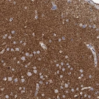 Immunohistochemical staining of human cerebral cortex shows high expression.