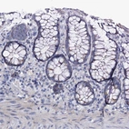 Immunohistochemical staining of human rectum shows low expression as expected.