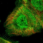 Immunofluorescent staining of human cell line A-431 shows localization to nucleoplasm, plasma membrane & cytosol.