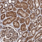 Anti-INTS10 Antibody