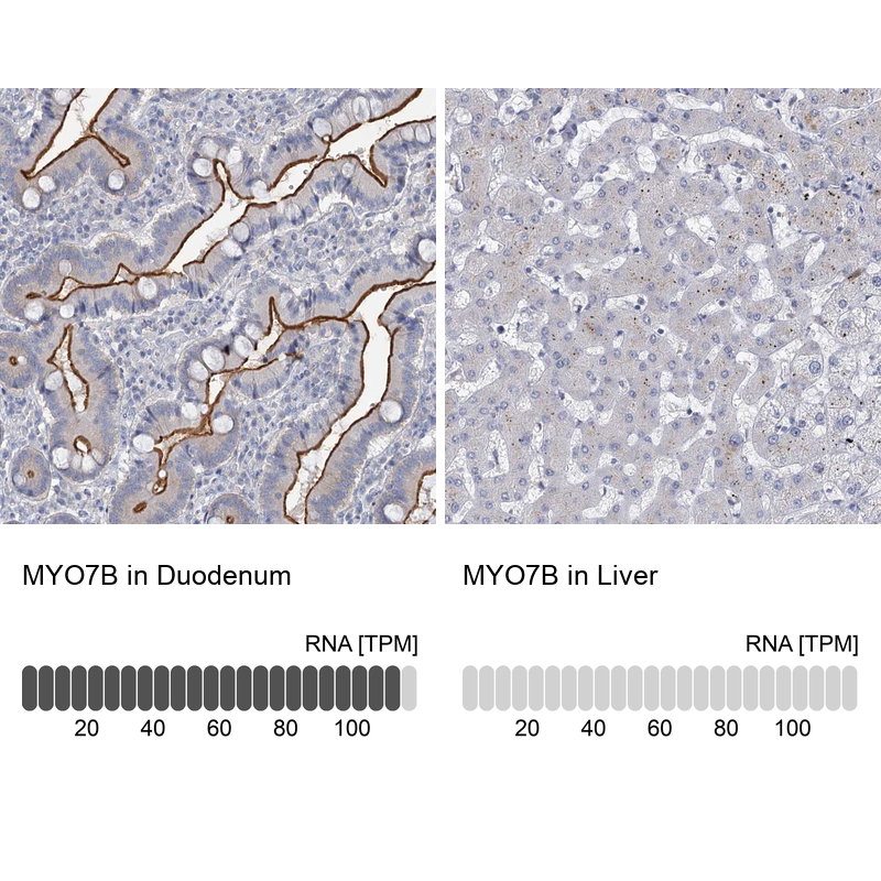 Anti-MYO7B Antibody