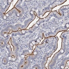 Anti-MYO7B Antibody
