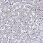 Immunohistochemical staining of human liver shows low expression as expected.