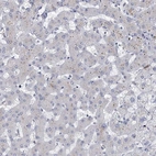 Immunohistochemical staining of human liver shows low expression as expected.
