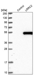 Anti-LRRC2 Antibody