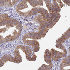 Anti-TMEM39A Antibody