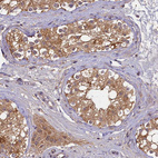 Immunohistochemical staining of human testis shows moderate to strong cytoplasmic positivity in cells in seminiferous ducts.