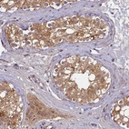 Immunohistochemical staining of human testis shows moderate to strong cytoplasmic positivity in cells in seminiferous ducts.
