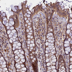Immunohistochemical staining of human rectum shows moderate to strong cytoplasmic positivity in glandular cells.