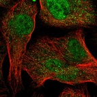 Immunofluorescent staining of human cell line U-2 OS shows localization to nucleoplasm & vesicles.