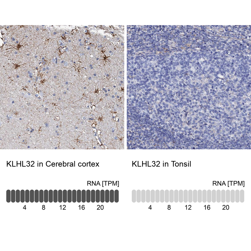 Anti-KLHL32 Antibody