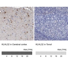 Anti-KLHL32 Antibody