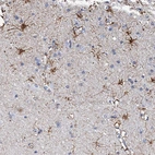 Immunohistochemical staining of human cerebral cortex shows high expression.