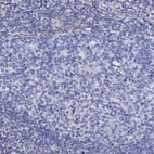 Anti-KLHL32 Antibody