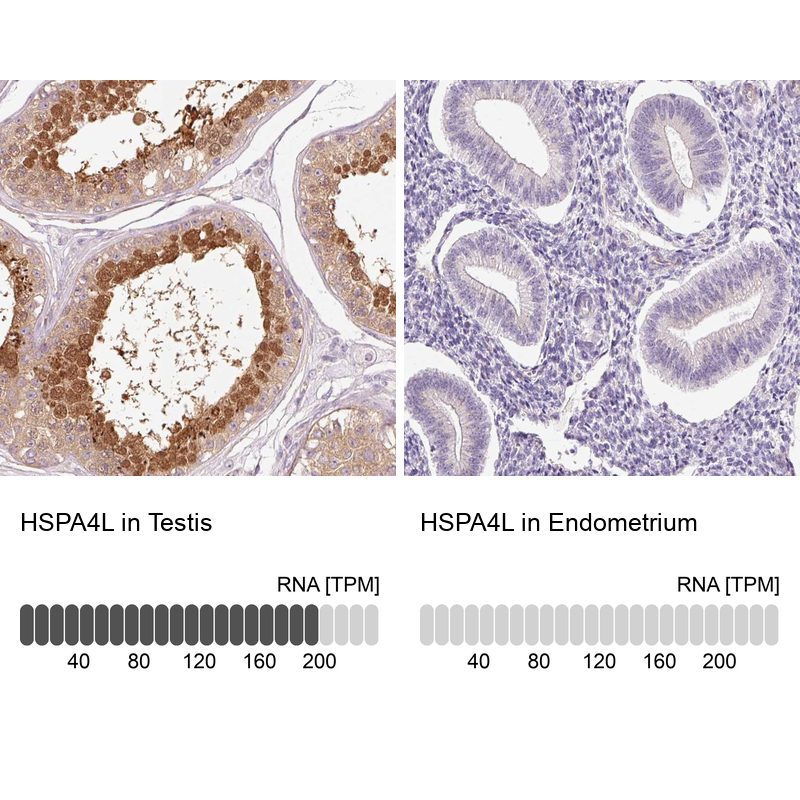 Anti-HSPA4L Antibody