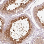 Immunohistochemical staining of human testis shows high expression.
