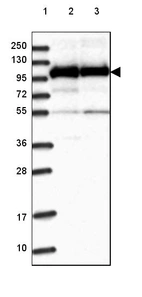 Lane 1: Marker [kDa] 250, 130, 95, 72, 55, 36, 28, 17, 10_br/_Lane 2: Human cell line RT-4_br/_Lane 3: Human cell line U-251 MG