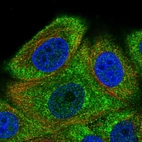 Immunofluorescent staining of human cell line MCF7 shows localization to cytosol.